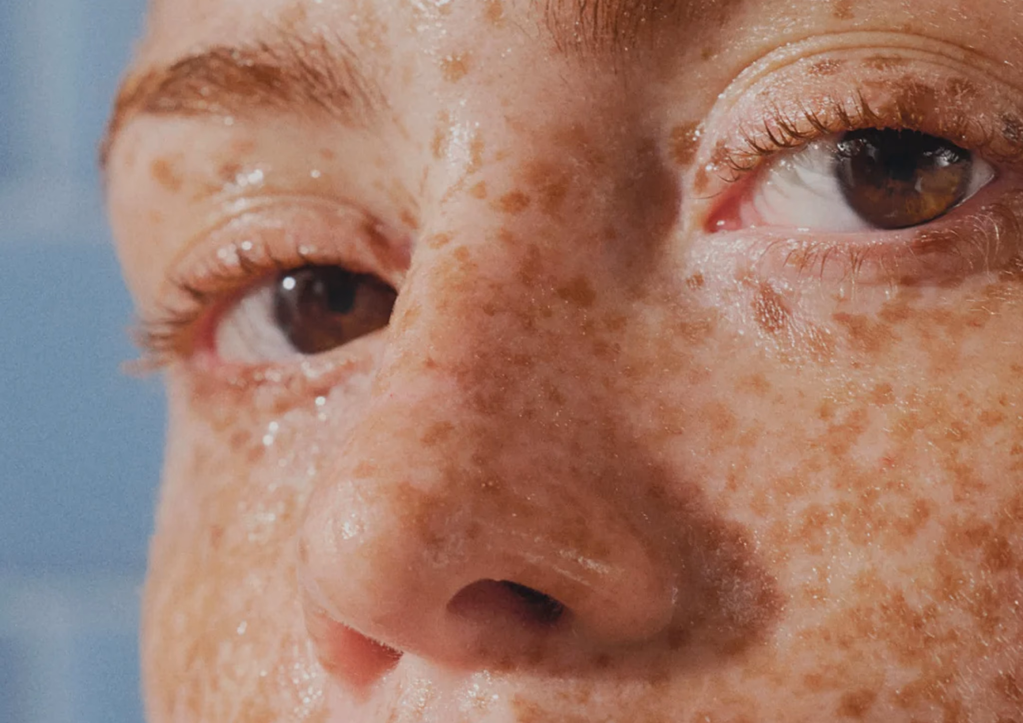 Close portrait with freckled skin
